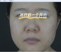 -厦门美莱整形美容医院