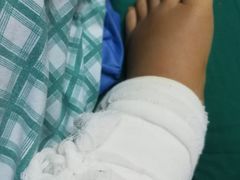 -广州中医药大学第三附属医院(骨伤科分院)