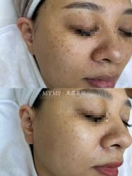 -美愈美肤MEIYU SKIN