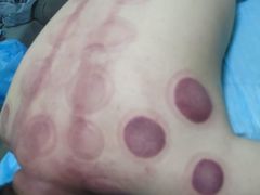 -张钰强中医正骨推拿连锁(唐家人才公寓店)