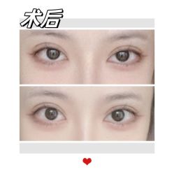 -素美医疗美容·西南眼鼻整形·修复基地