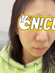 体验前-杭州米兰柏羽医疗美容医院