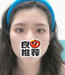 -久匠半永久纹眉