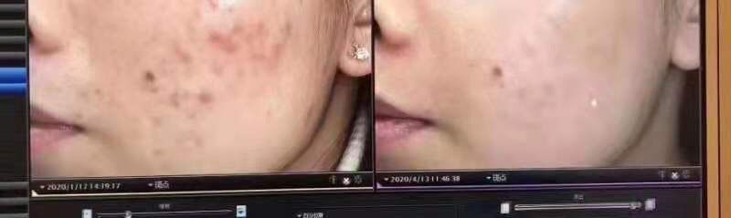 点击看大图 -苑苑vbeauty科技美容SPA