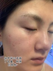体验后-纯粹医美