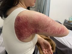 -承启堂中医馆·推拿·针灸(成华馆)