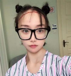 -碧莲盛·不剃发植发