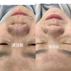 -蕾特恩专业祛痘·皮肤管理