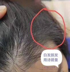 -诗碧曼养发