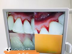 -李桂凤口腔
