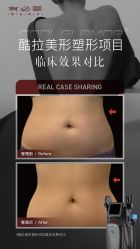 -JY·VALMONT法儿曼官方面护·海菲秀黑钻体验中心