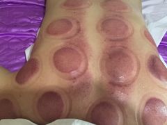 -益友堂盲人推拿正骨穴位按摩工作室