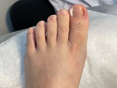 -世龙世家灰指甲鸡眼脚气甲沟炎跖疣护理(通州店)