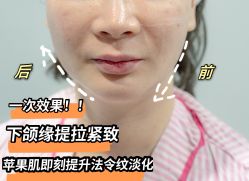 -上海漾颜医疗美容