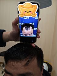 -碧莲盛·不剃发植发