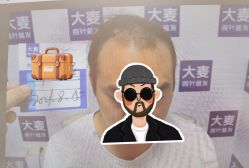 体验前-大麦微针植发丨全国连锁