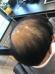 -唐风采假发补发定制