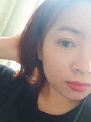 -百世玉芳专业祛痘