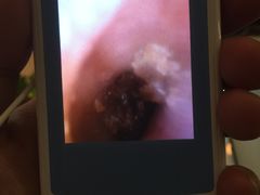 -铭洋专业采耳(田子坊店)