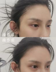 -西施无菌半永久纹绣眉眼影唇轻增发纹发际线