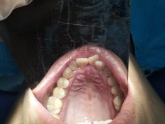-微笑牙科口腔(三亚迎宾院区)