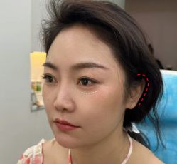 点击看大图 体验前-Yestar艺星医疗美容医院