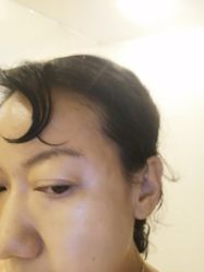 -天津健丽·去眼袋医疗美容机构