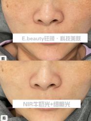 -E.beauty驻颜·痘敏肌调理中心