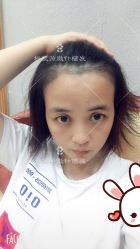 -大麦微针植发丨全国连锁