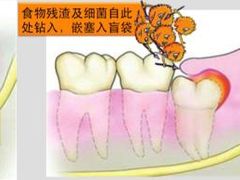 -团圆口腔·种植中心(锦江院区)