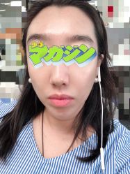 -八大处整形