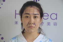 点击看大图 -禾美嘉医疗美容