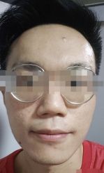 点击看大图 -痘博士广州·全国连锁祛痘机构