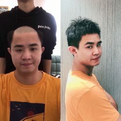 -发饰美男士增发补发假发定制店