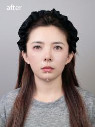 -Yestar艺星医疗美容医院