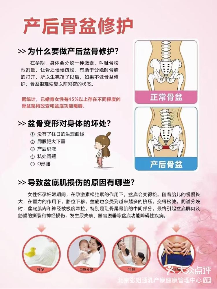 骨盆修复最佳时间图片