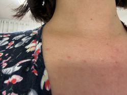 -莱可美科技美肤