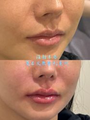 -北京米扬丽格医疗美容·联合丽格鼻整形中心