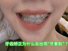 -团圆口腔·种植中心(锦江院区)