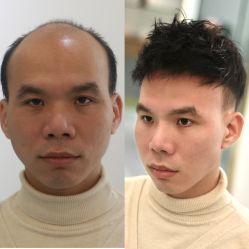 -发饰美男士增发补发假发定制店