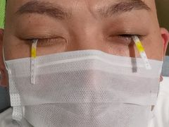 -黑马眼科·近视手术
