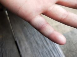 -苏州大学附属儿童医院(园区总院)