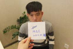 -大麦微针植发丨全国连锁