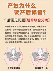 -安院长·产后恢复·徒手骨盆(先天下店)