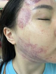 体验后-上海首尔丽格医疗美容医院