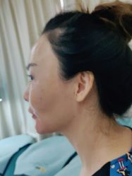 点击看大图 体验后-深圳阳光医疗美容医院·旗舰店