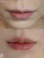 -上海漾颜医疗美容