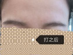 -洁铭新加坡医美