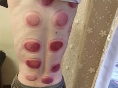 -沈师傅盲人按摩工作室(密三小区店)