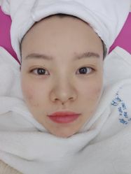 -痘瑞仕·专业祛痘国际连锁